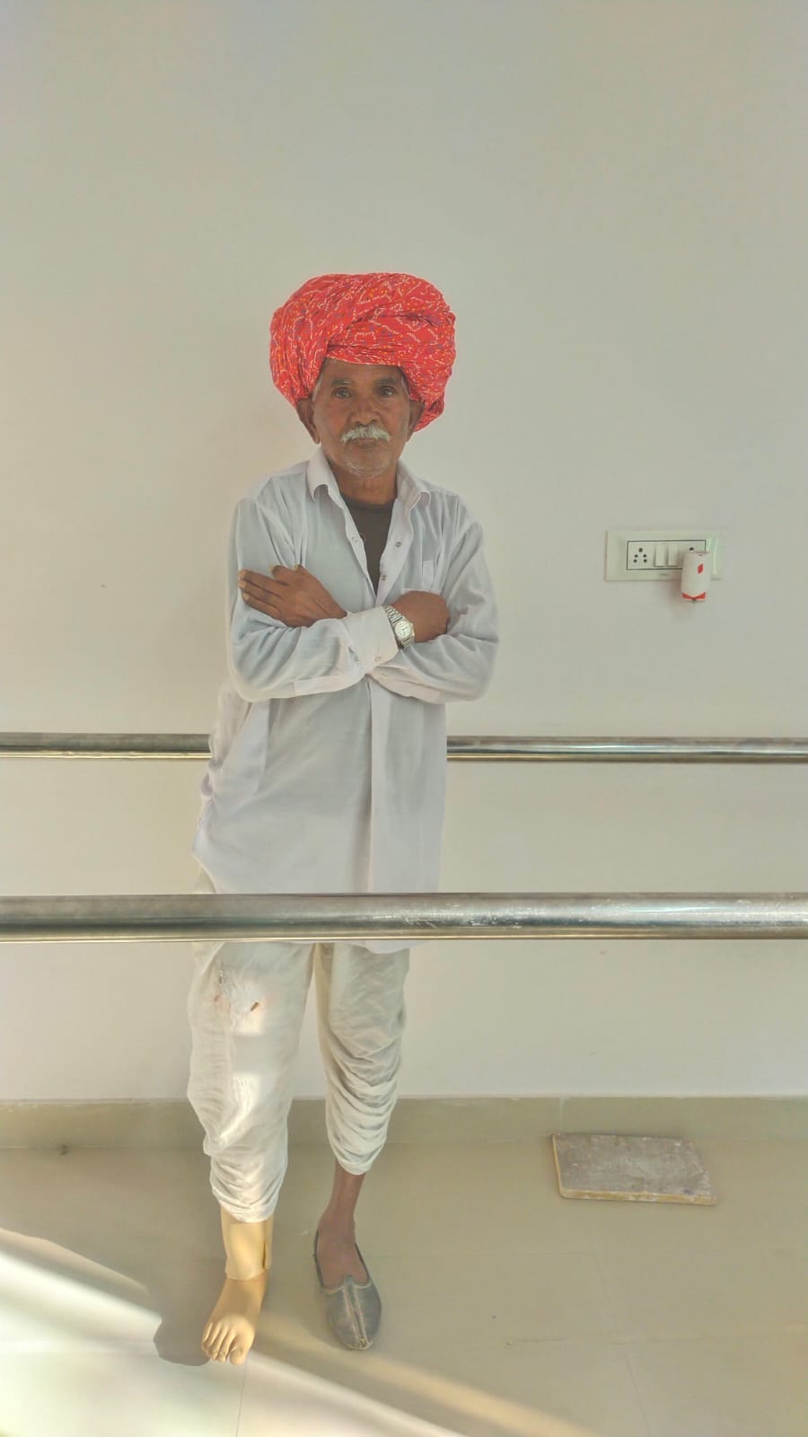 Patient learning to walk on a premium carbon fiber prosthetic foot inside our Malviya Nagar clinic